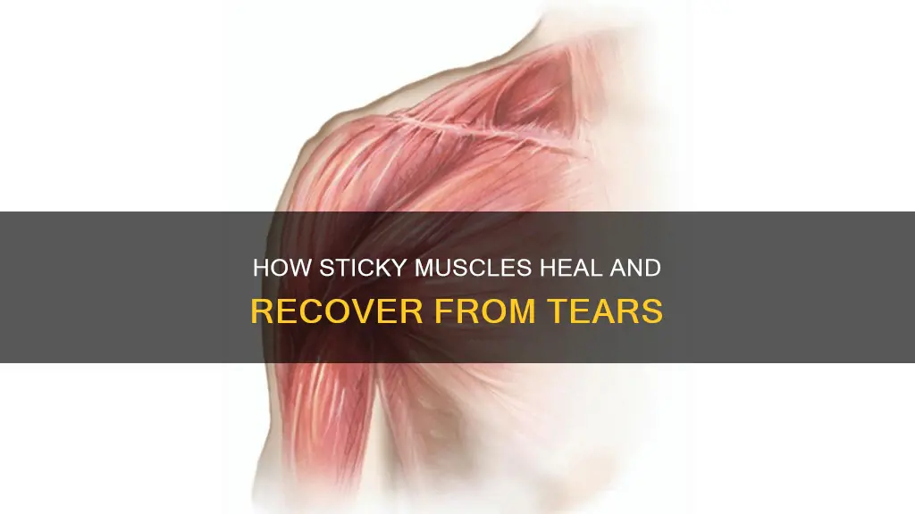 why are torn muscles sticky