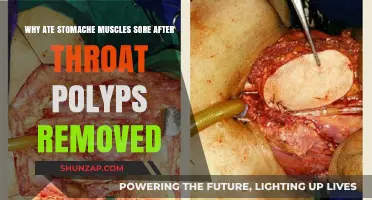 Post-Polyp Removal: Understanding Sore Stomach Muscles After Throat Surgery