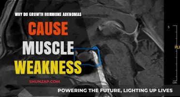 How Growth Hormone Adenomas Lead to Unexpected Muscle Weakness