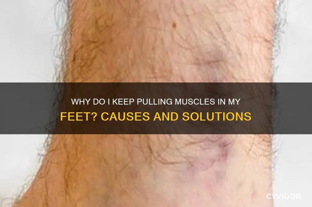 why do i keep pulling muscles in my feet