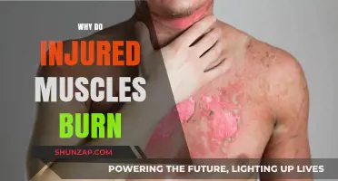 The Science Behind Burning Muscles: Why Do They Hurt?