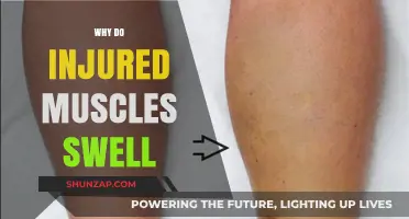 Injured Muscles Swell: Understanding the Inflammation Response