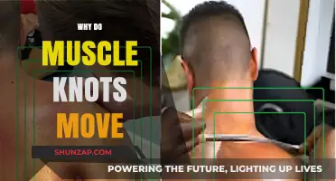 Unraveling the Mystery of Migrating Muscle Knots