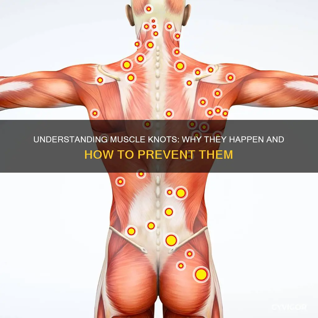why do muscle knots