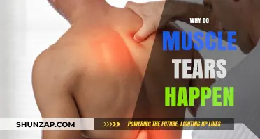 Understanding Muscle Tears: Causes and Prevention