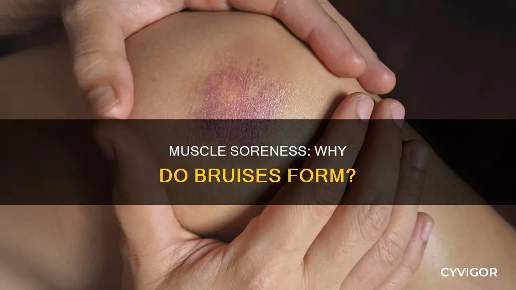 why do muscles feel bruised