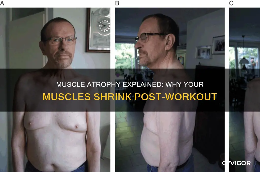 why do muscles get smaller afyer i stop working out