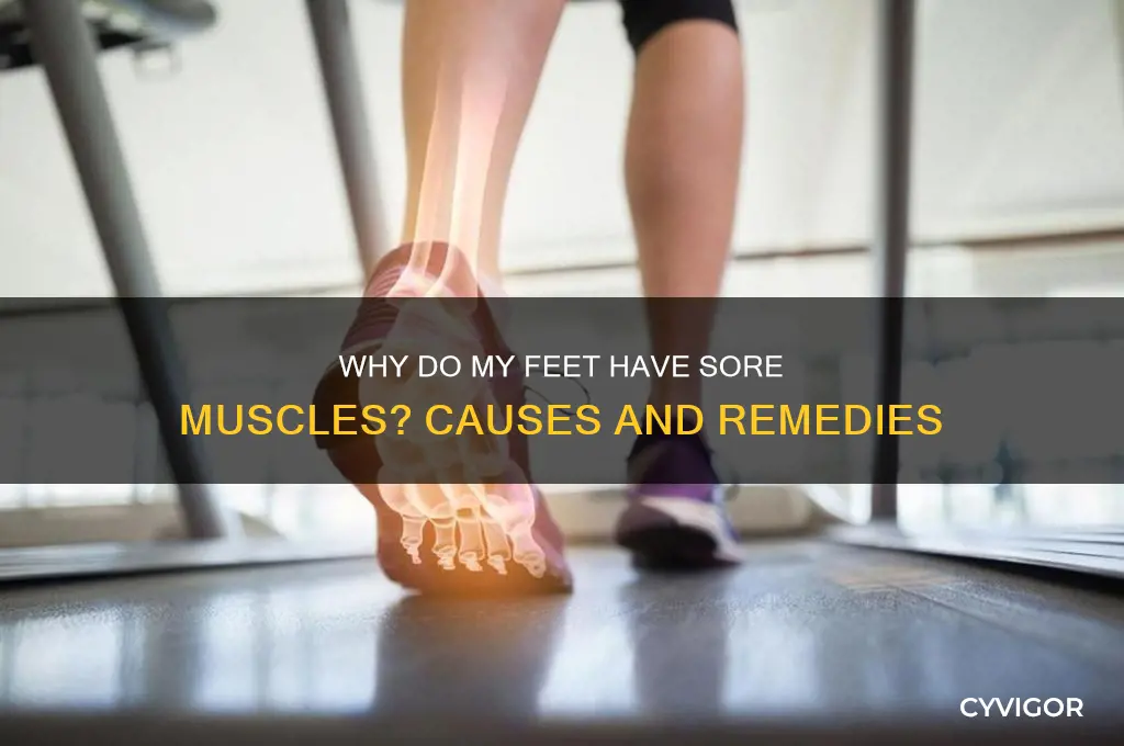 why do my feet have sore muscle