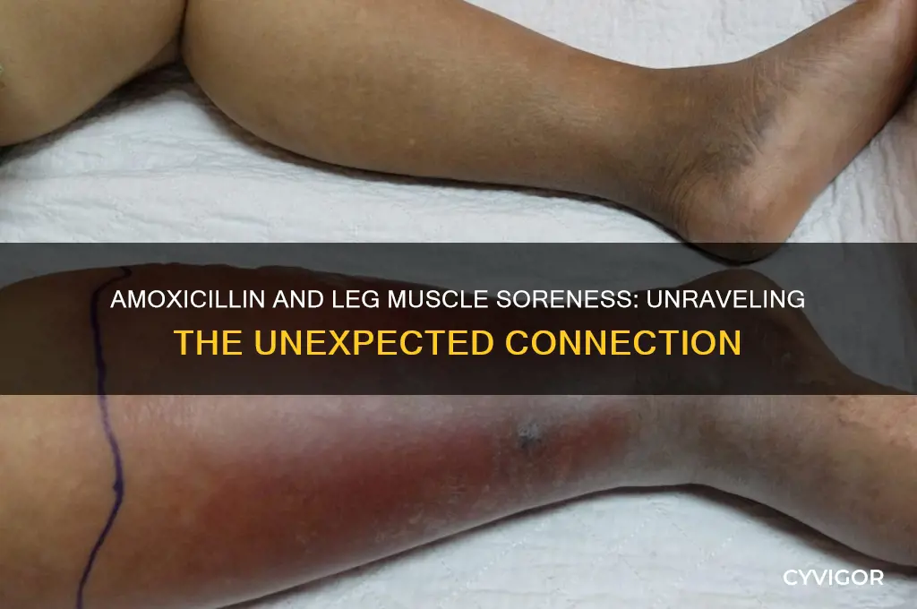 why do my leg muscles feel sore when taking amoxicillin