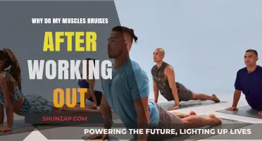 Post-Workout Muscle Bruising: Causes, Prevention, and Recovery Explained