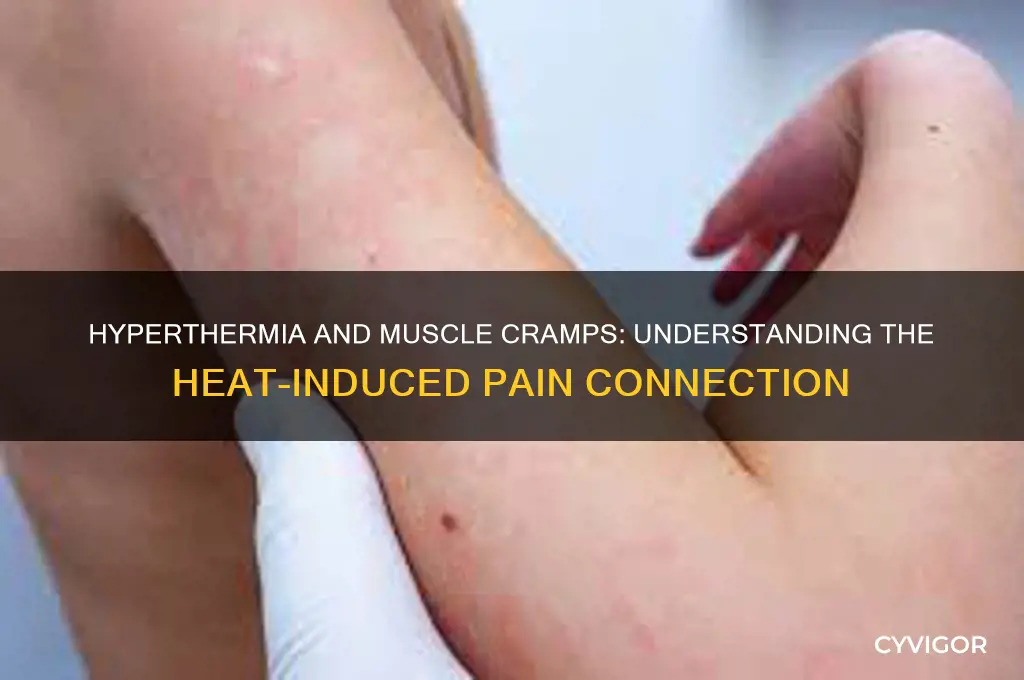 why does hyperthermia cause muscle cramps