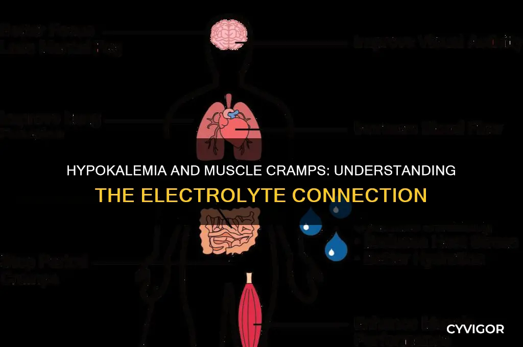 why does hypokalemia cause muscle cramps