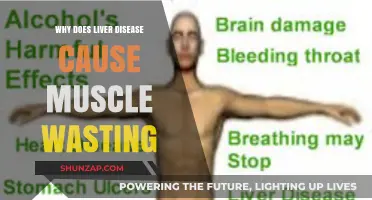 Liver Disease and Muscle Wasting: Understanding the Hidden Connection