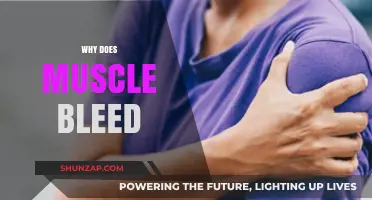 Muscle Bleeding: Why Does It Happen?