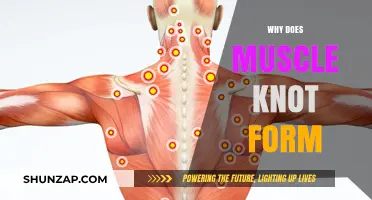 Muscle Knots: Why Do They Form?