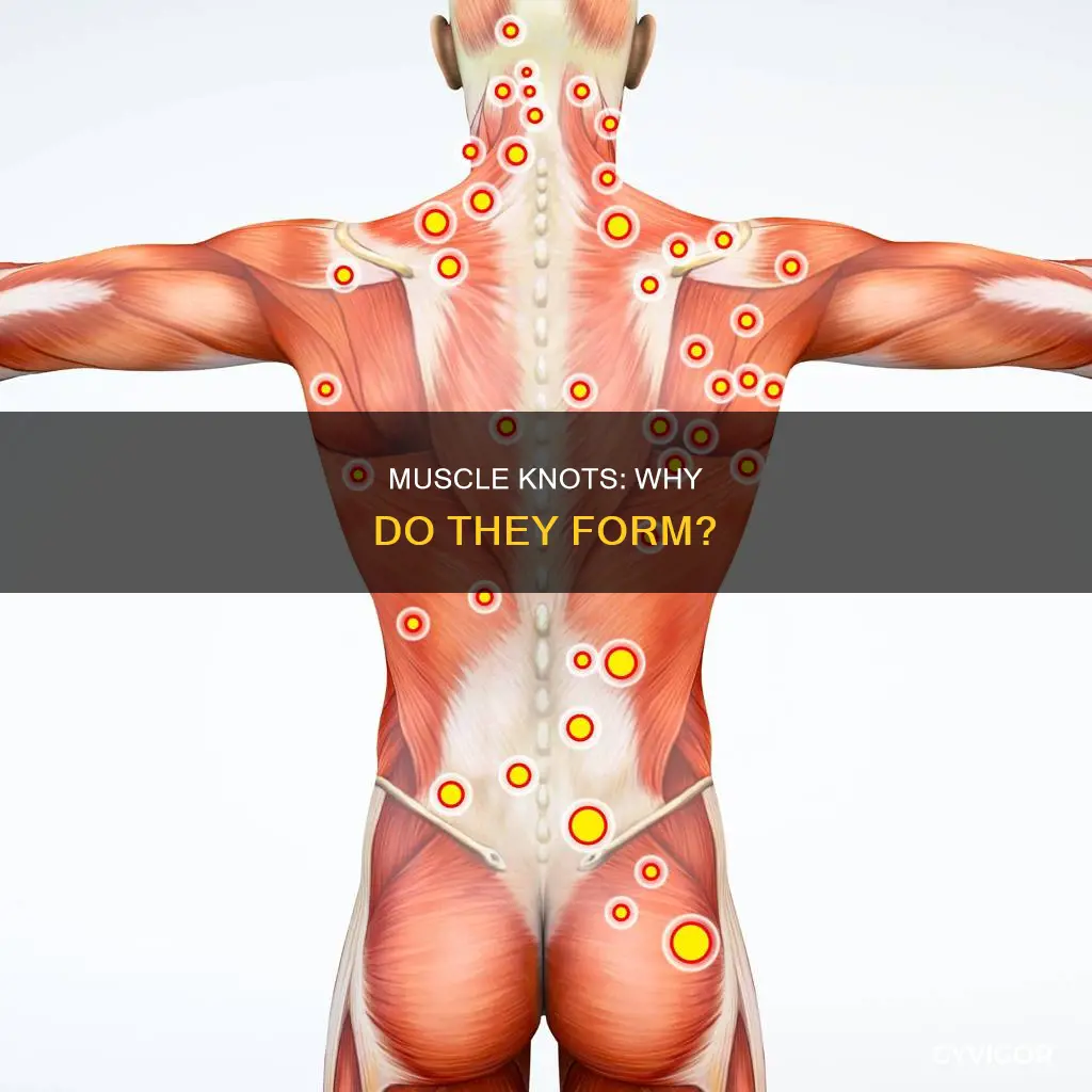 why does muscle knot form