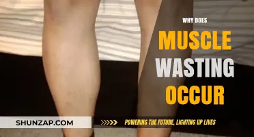 Understanding Muscle Wasting: Causes and Prevention
