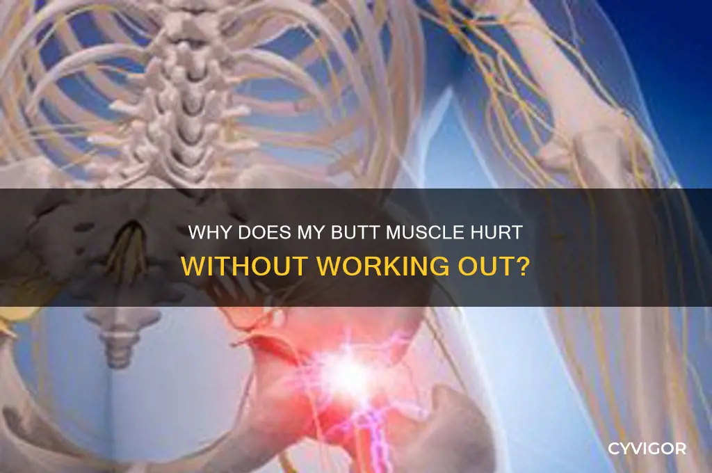 why does my butt muscle hurt without working out