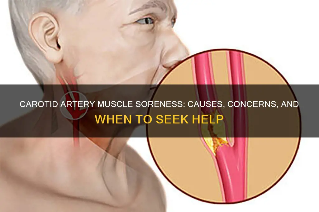 why does my carotid artery muscle area feel sore