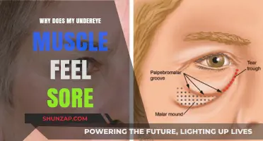 Why Your Undereye Muscle Feels Sore: Causes and Remedies