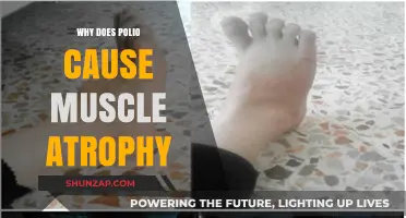 Polio's Impact: Unraveling the Mystery of Muscle Atrophy