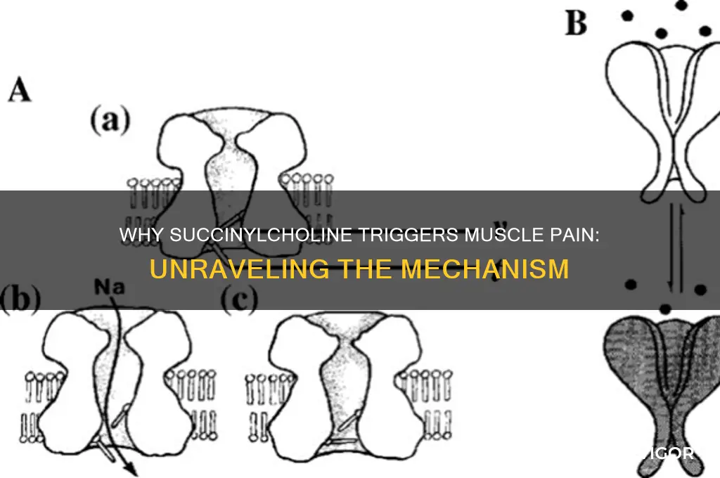 why does succinylcholine cause muscle pain