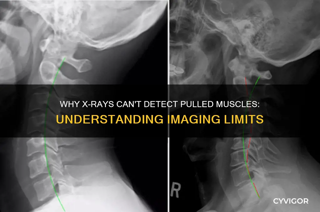why dont x rays show a pulled muscle