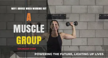 Why Do I Bruise When Working Out a Muscle Group?