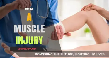 Icing Muscle Injuries: Reducing Inflammation and Pain