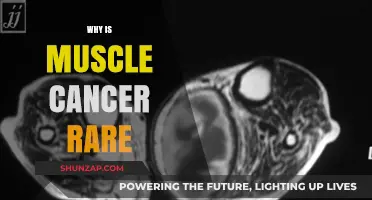 Muscle Cancer: Why So Rare?
