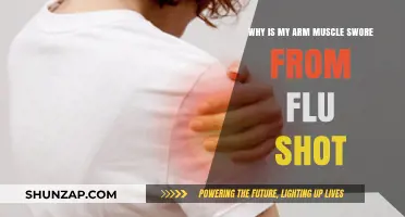 Flu Shot Arm Soreness: Causes and Relief Explained