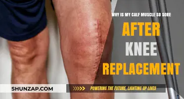 Calf Muscle Soreness After Knee Replacement: Causes and Relief Tips