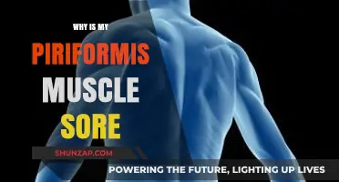 Why Your Piriformis Muscle Hurts: Causes, Relief, and Prevention Tips