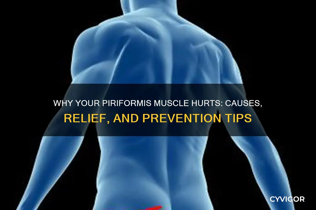 why is my piriformis muscle sore