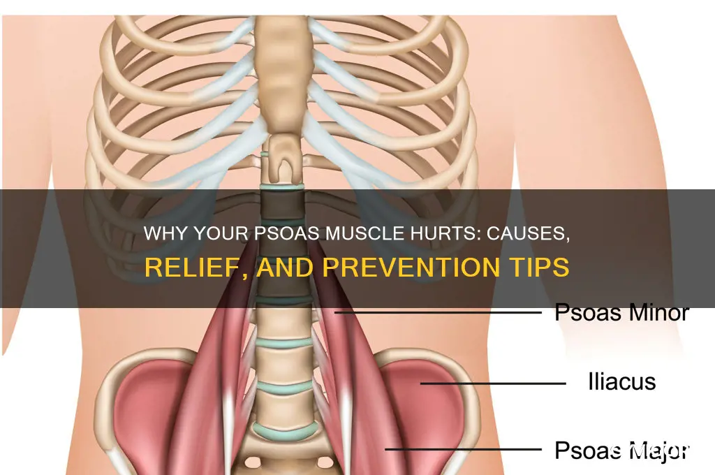 why is my psoas muscle sore