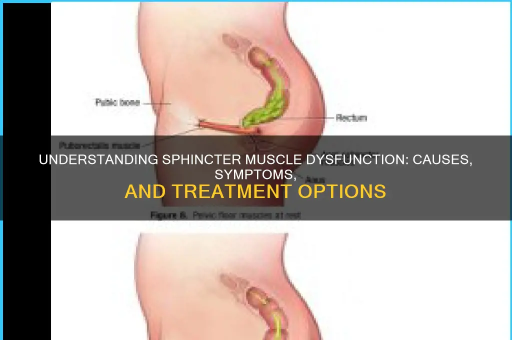 why is my sphincter muscle not working