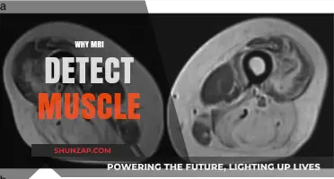 MRI's Muscle-Detecting Superpowers Explained
