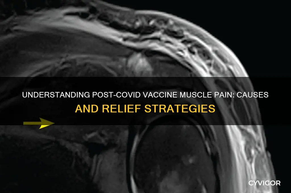 why muscle pain after covid vaccine