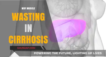 Muscle Wasting in Cirrhosis: Understanding the Complex Connection