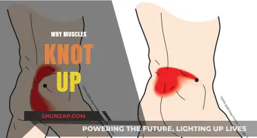 Muscle Knots: Why Do They Happen?