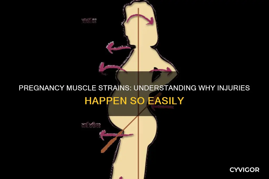 why so easy to pull a muscle in pregnancy
