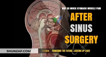 Post-Sinus Surgery Stomach Muscle Pain: Causes and Relief Explained