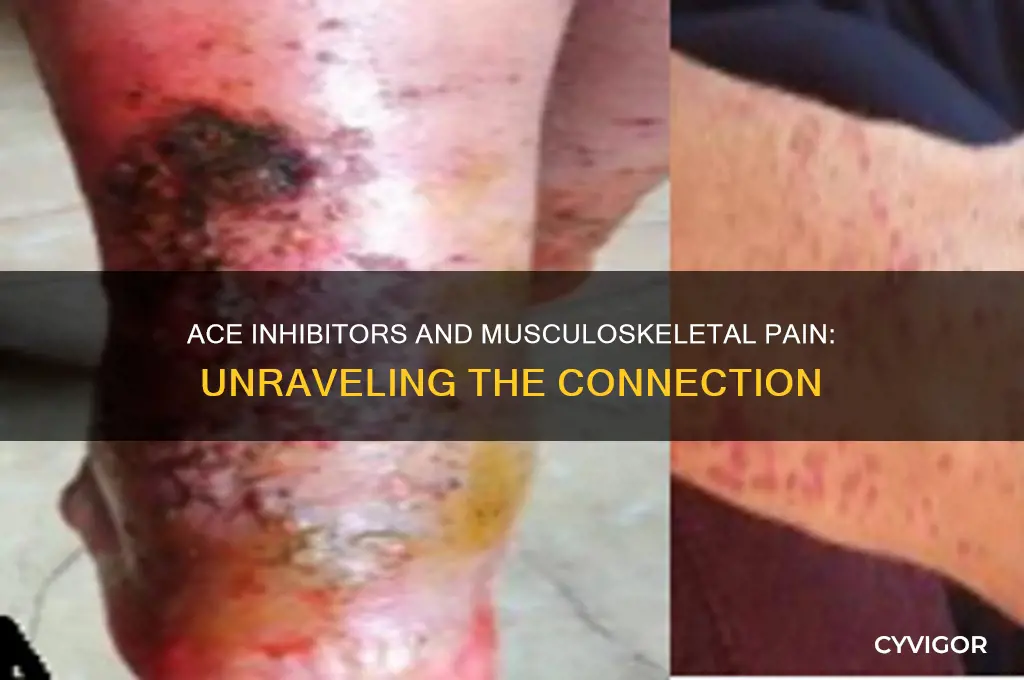 why would ace inhibitors cause muscle and tendon pain