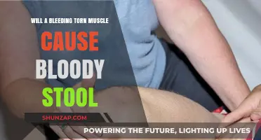 Bleeding Torn Muscle and Bloody Stool: Understanding the Connection