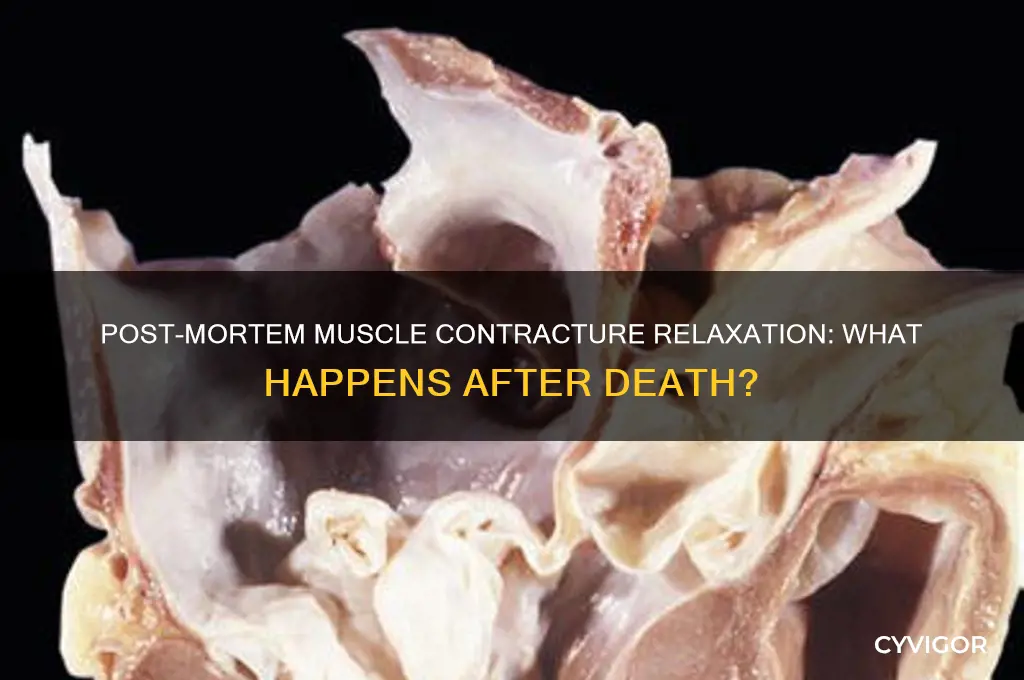 will a muscle contracture relax after the patient dies