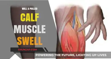 Pulled Calf Muscle Swelling: Causes, Symptoms, and Recovery Tips