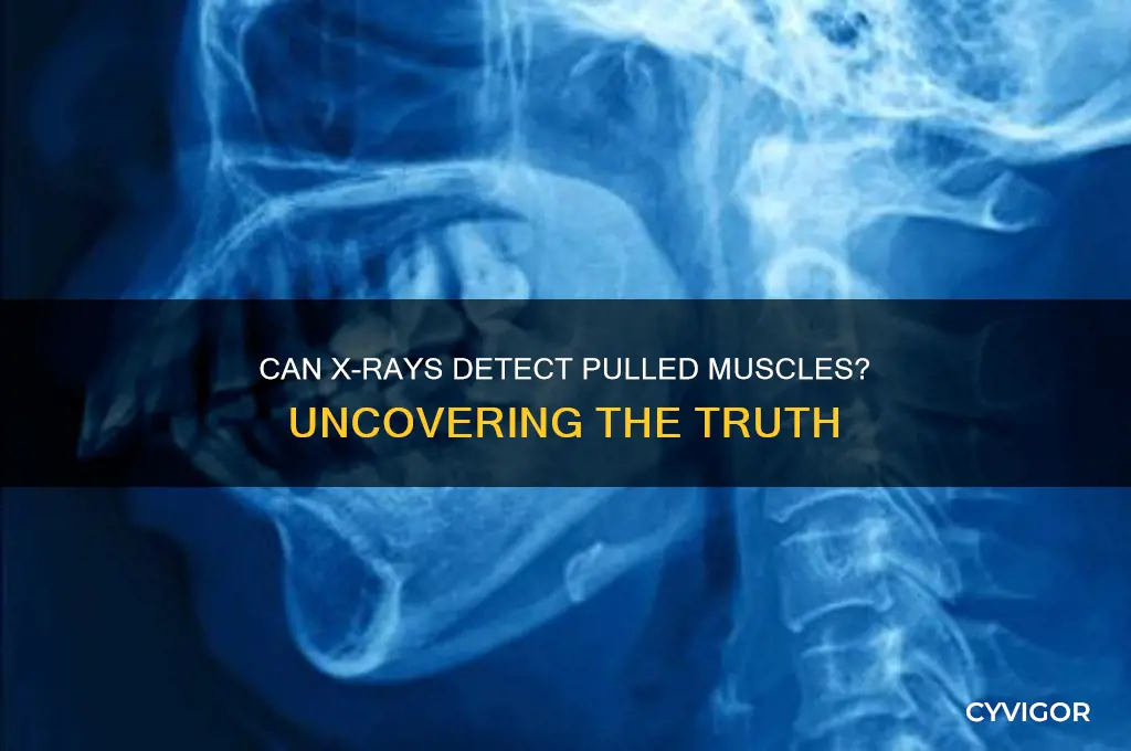 will a pulled muscle show up on xray