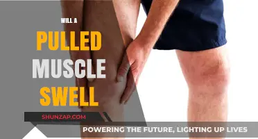 Pulled Muscle Swelling: Causes, Symptoms, and Effective Treatment Options