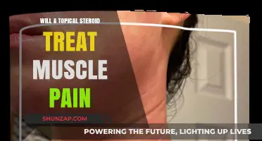 Can Topical Steroids Effectively Relieve Muscle Pain? Expert Insights