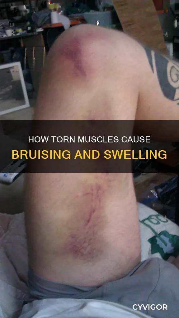 will a torn muscle bruise